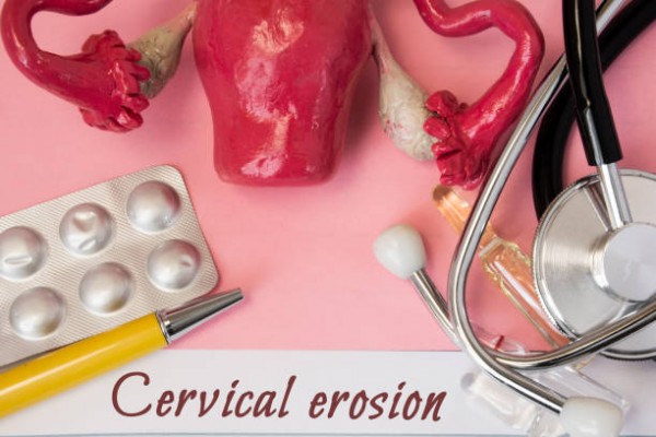 10 Địa chỉ chữa viêm lộ tuyến cổ tử cung ở đâu tốt nhất Hà Nội